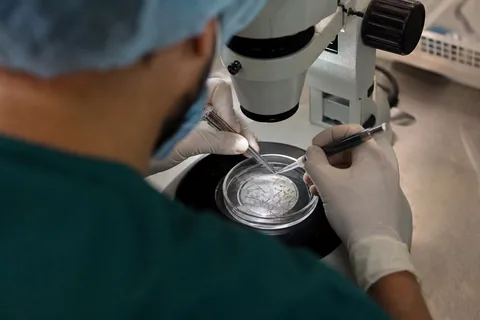 Gloved hands sorting follicular unit grafts under a microscope